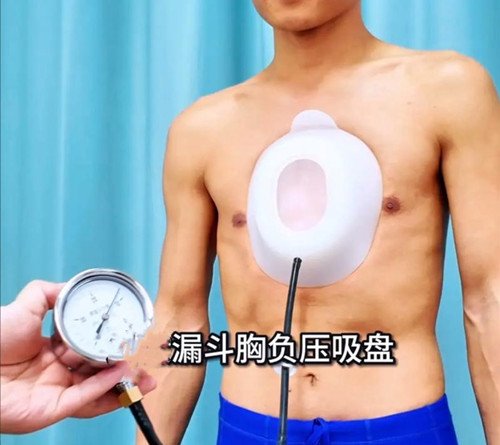 漏斗胸怎么矯正？