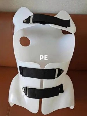 脊柱側(cè)彎支具材料的使用