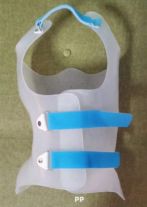 脊柱側(cè)彎支具材料的使用